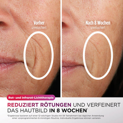 Shark CryoGlow LED Lichttherapie Maske mit Kühlfunktion – FW312EUPL